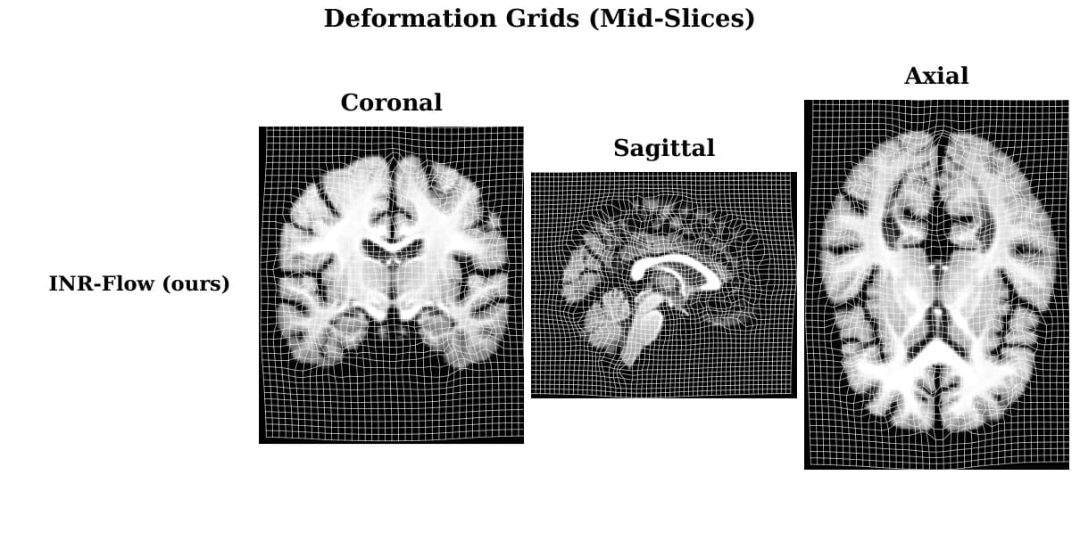 Deformation grid visualisation