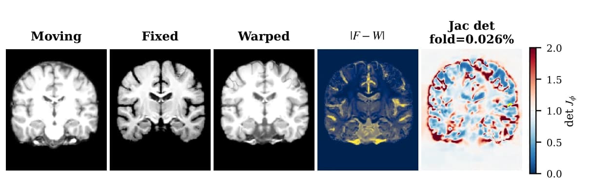 Moving image, fixed image and the warped result