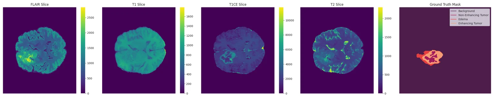 Four MRI modalities beside the labelled ground truth mask