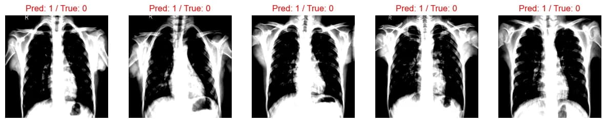 Misclassified radiographs