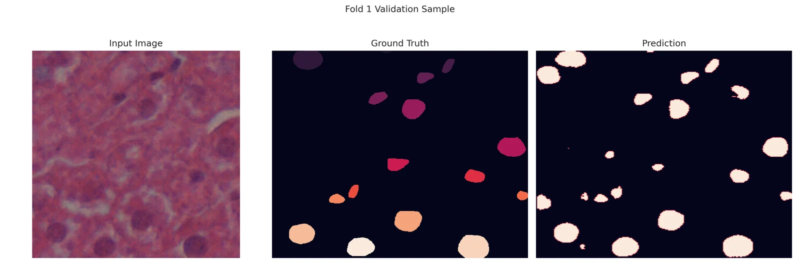 Teaching a foundation model to see nuclei output