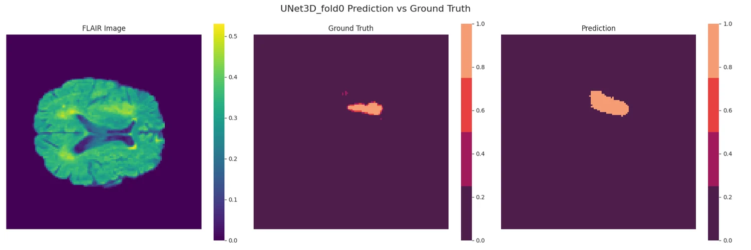 Volumetric tumor segmentation, and why the spread matters output