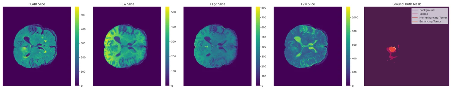 Multi modal MRI samples